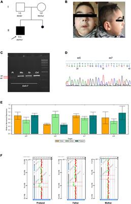 A Phenotypic-Driven Approach for the Diagnosis of WOREE Syndrome